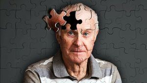 Un nuevo tratamiento para el Alzheimer