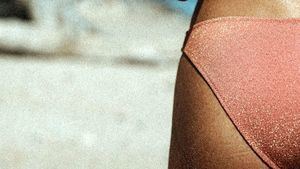 Más del 85% de las mujeres en España tienen apariencia visible de celulitis